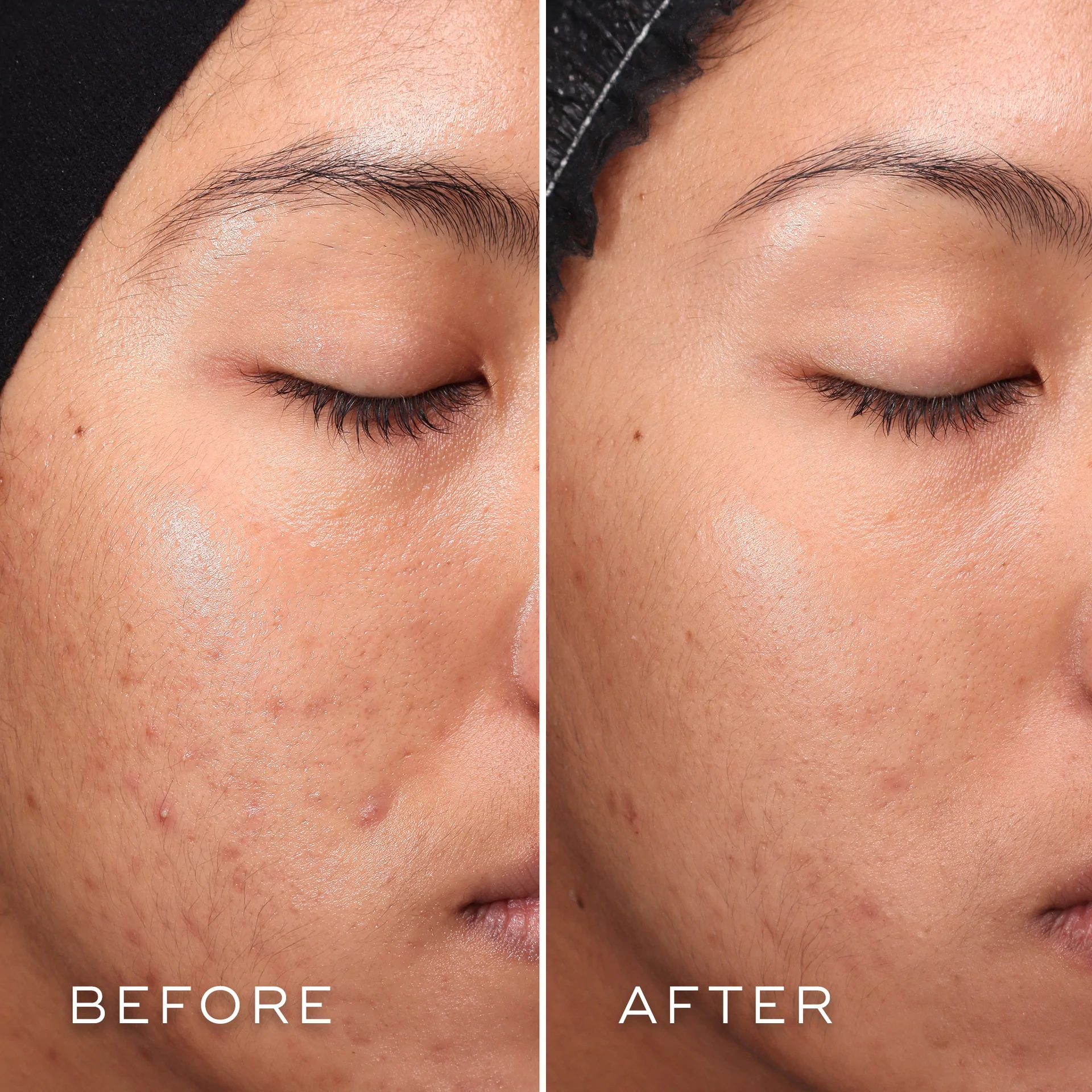 Press_Clear-GreyBackground-US-Before-After.webp